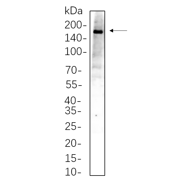 WR4433 HepG2 whole cell lysates were separated by 10% SDS-PAGE, and the membrane was blotted with primary antibody(1:1000). The HRP-conjugated Goat anti-Rabbit IgG(H + L) antibody was used to detect the antibody. HepG2 whole cell lysates were separated by 10% SDS-PAGE, and the membrane was blotted with primary antibody(1:1000). The HRP-conjugated Goat anti-Rabbit IgG(H + L) antibody was used to detect the antibody.