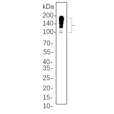 Mouse colon cell lysates were separated by 4-20% SDS-PAGE, and the membrane was blotted with primary antibody 1:1000. The HRP-conjugated Goat anti-Rabbit IgG(H + L) antibody was used to detect the antibody.