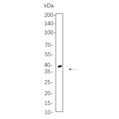 Rat lung cell lysates were separated by 4-20% SDS-PAGE, and the membrane was blotted with primary antibody 1:1000. The HRP-conjugated Goat anti-Rabbit IgG(H + L) antibody was used to detect the antibody.