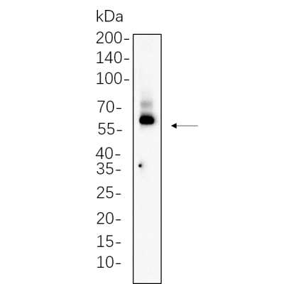 HT-29 whole cell lysates were separated by 10% SDS-PAGE, and the membrane was blotted with primary antibody(1:1000). The HRP-conjugated Goat anti-Rabbit IgG(H + L) antibody was used to detect the antibody.