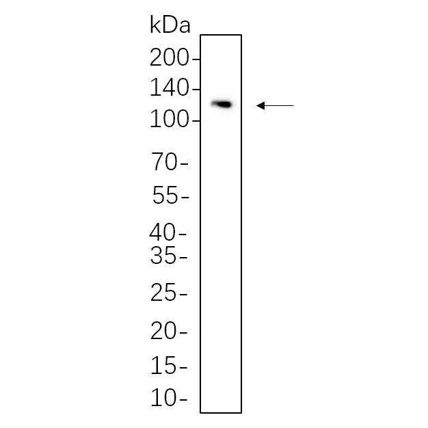 WR4447 Hela cell lysates were separated by 4-20% SDS-PAGE, and the membrane was blotted with primary antibody 1:1000. The HRP-conjugated Goat anti-Rabbit IgG(H + L) antibody was used to detect the antibody. Hela cell lysates were separated by 4-20% SDS-PAGE, and the membrane was blotted with primary antibody 1:1000. The HRP-conjugated Goat anti-Rabbit IgG(H + L) antibody was used to detect the antibody.