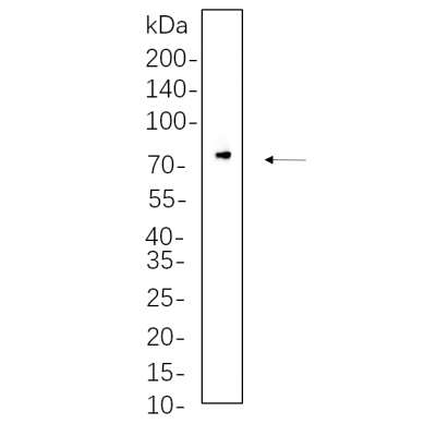 C6 cell lysates were separated by 4-20% SDS-PAGE, and the membrane was blotted with primary antibody 1:1000. The HRP-conjugated Goat anti-Rabbit IgG(H + L) antibody was used to detect the antibody.