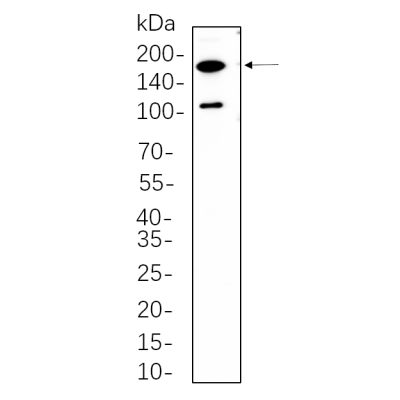 C2C12 whole cell lysates were separated by 10% SDS-PAGE, and the membrane was blotted with primary antibody(1:1000). The HRP-conjugated Goat anti-Rabbit IgG(H + L) antibody was used to detect the antibody.