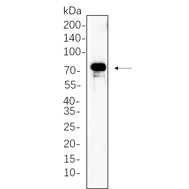WR4453 Rat womb whole cell lysates were separated by 10% SDS-PAGE, and the membrane was blotted with primary antibody(1:1000). The HRP-conjugated Goat anti-Rabbit IgG(H + L) antibody was used to detect the antibody. Rat womb whole cell lysates were separated by 10% SDS-PAGE, and the membrane was blotted with primary antibody(1:1000). The HRP-conjugated Goat anti-Rabbit IgG(H + L) antibody was used to detect the antibody.