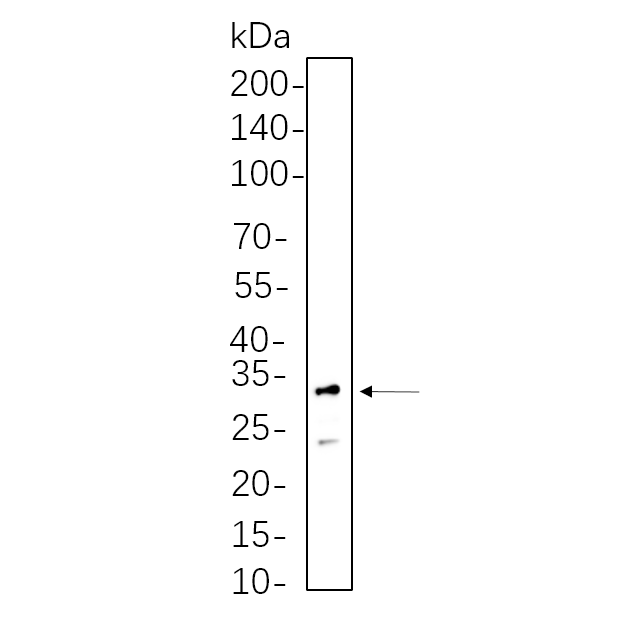 WR4456 3T3-L1 cell lysates were separated by 4-20% SDS-PAGE, and the membrane was blotted with primary antibody 1:1000. The HRP-conjugated Goat anti-Rabbit IgG(H + L) antibody was used to detect the antibody. 3T3-L1 cell lysates were separated by 4-20% SDS-PAGE, and the membrane was blotted with primary antibody 1:1000. The HRP-conjugated Goat anti-Rabbit IgG(H + L) antibody was used to detect the antibody.