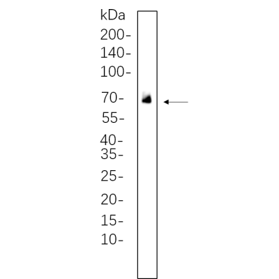 U-14 whole cell lysates were separated by 10% SDS-PAGE, and the membrane was blotted with primary antibody(1:1000). The HRP-conjugated Goat anti-Rabbit IgG(H + L) antibody was used to detect the antibody.