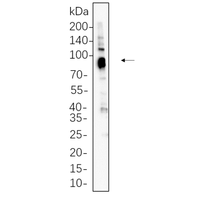 A431 whole cell lysates were separated by 10% SDS-PAGE, and the membrane was blotted with primary antibody(1:1000). The HRP-conjugated Goat anti-Rabbit IgG(H + L) antibody was used to detect the antibody.