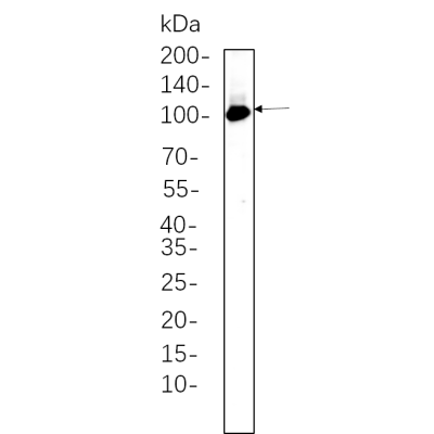 Rat brain whole cell lysates were separated by 10% SDS-PAGE, and the membrane was blotted with primary antibody(1:1000). The HRP-conjugated Goat anti-Rabbit IgG(H + L) antibody was used to detect the antibody.