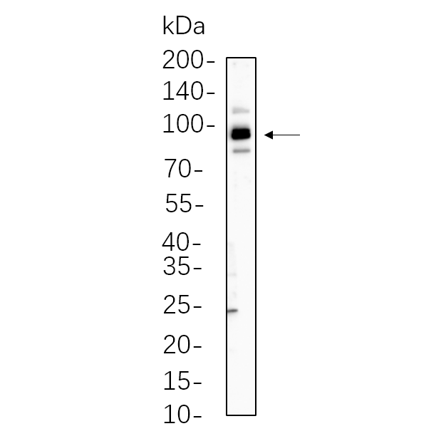 WR4472 A549 cell lysates were separated by 4-20% SDS-PAGE, and the membrane was blotted with primary antibody 1:1000. The HRP-conjugated Goat anti-Rabbit IgG(H + L) antibody was used to detect the antibody. A549 cell lysates were separated by 4-20% SDS-PAGE, and the membrane was blotted with primary antibody 1:1000. The HRP-conjugated Goat anti-Rabbit IgG(H + L) antibody was used to detect the antibody.