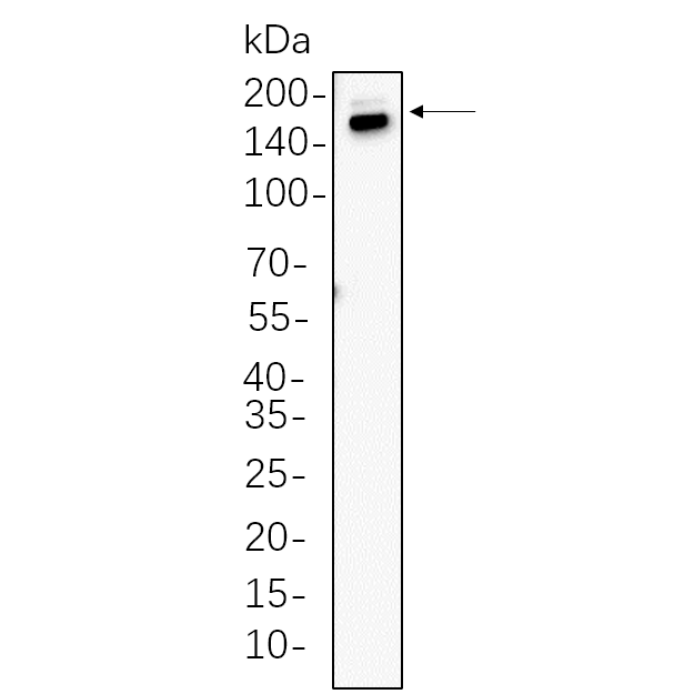 WR4473 C2C12 whole cell lysates were separated by 10% SDS-PAGE, and the membrane was blotted with primary antibody(1:1000). The HRP-conjugated Goat anti-Rabbit IgG(H + L) antibody was used to detect the antibody. C2C12 whole cell lysates were separated by 10% SDS-PAGE, and the membrane was blotted with primary antibody(1:1000). The HRP-conjugated Goat anti-Rabbit IgG(H + L) antibody was used to detect the antibody.
