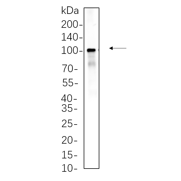 WR4477 Hela whole cell lysates were separated by 10% SDS-PAGE, and the membrane was blotted with primary antibody(1:1000). The HRP-conjugated Goat anti-Rabbit IgG(H + L) antibody was used to detect the antibody. Hela whole cell lysates were separated by 10% SDS-PAGE, and the membrane was blotted with primary antibody(1:1000). The HRP-conjugated Goat anti-Rabbit IgG(H + L) antibody was used to detect the antibody.