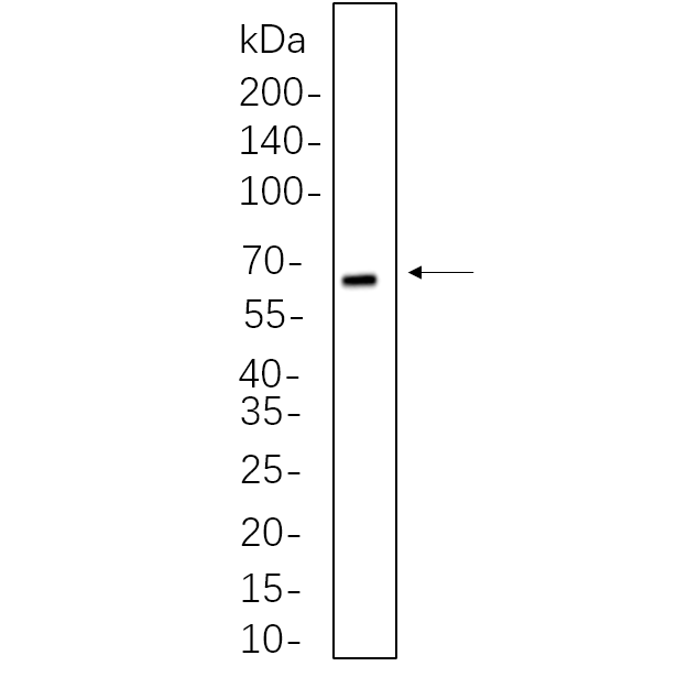 WR4479 RAW264.7 whole cell lysates were separated by 10% SDS-PAGE, and the membrane was blotted with primary antibody(1:1000). The HRP-conjugated Goat anti-Rabbit IgG(H + L) antibody was used to detect the antibody. RAW264.7 whole cell lysates were separated by 10% SDS-PAGE, and the membrane was blotted with primary antibody(1:1000). The HRP-conjugated Goat anti-Rabbit IgG(H + L) antibody was used to detect the antibody.
