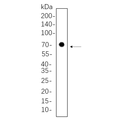 Hela whole cell lysates were separated by 10% SDS-PAGE, and the membrane was blotted with primary antibody(1:1000). The HRP-conjugated Goat anti-Rabbit IgG(H + L) antibody was used to detect the antibody.