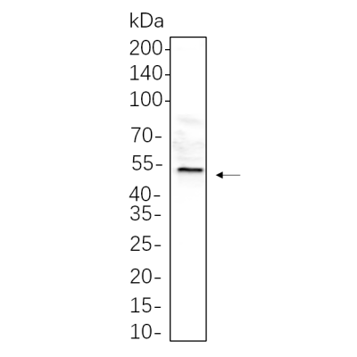 C6 whole cell lysates were separated by 10% SDS-PAGE, and the membrane was blotted with primary antibody(1:1000). The HRP-conjugated Goat anti-Rabbit IgG(H + L) antibody was used to detect the antibody.
