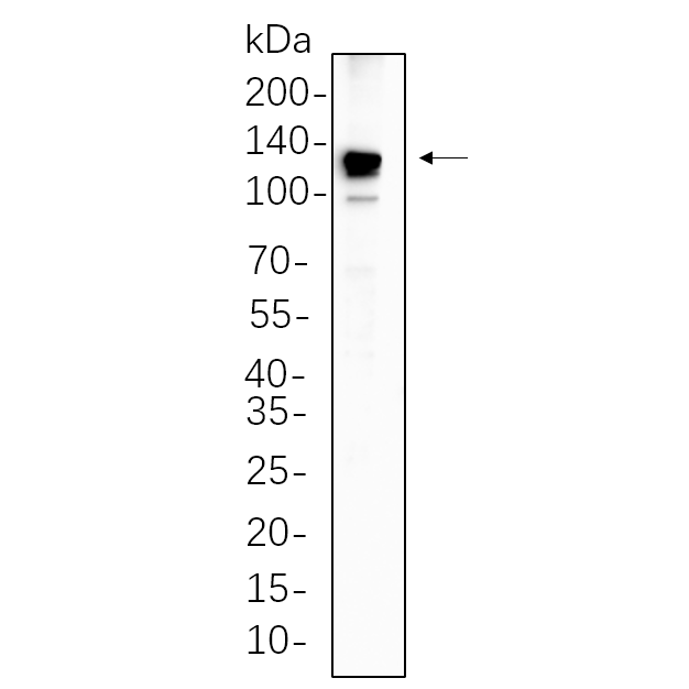 WR4490 Raji cell lysates were separated by 4-20% SDS-PAGE, and the membrane was blotted with primary antibody 1:1000. The HRP-conjugated Goat anti-Rabbit IgG(H + L) antibody was used to detect the antibody. Raji cell lysates were separated by 4-20% SDS-PAGE, and the membrane was blotted with primary antibody 1:1000. The HRP-conjugated Goat anti-Rabbit IgG(H + L) antibody was used to detect the antibody.
