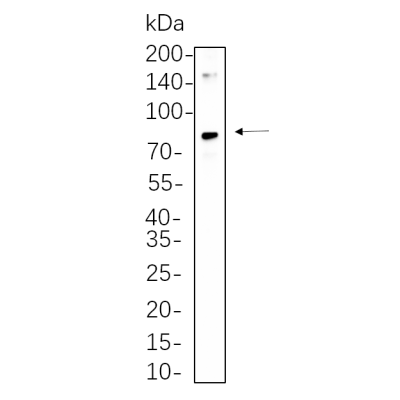 SW480 whole cell lysates were separated by 10% SDS-PAGE, and the membrane was blotted with primary antibody(1:1000). The HRP-conjugated Goat anti-Rabbit IgG(H + L) antibody was used to detect the antibody.