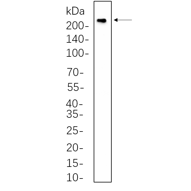 WR4498 Rat heart cell lysates were separated by 4-20% SDS-PAGE, and the membrane was blotted with primary antibody 1:1000. The HRP-conjugated Goat anti-Rabbit IgG(H + L) antibody was used to detect the antibody. Rat heart cell lysates were separated by 4-20% SDS-PAGE, and the membrane was blotted with primary antibody 1:1000. The HRP-conjugated Goat anti-Rabbit IgG(H + L) antibody was used to detect the antibody.