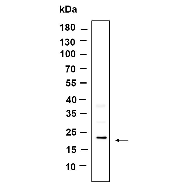 WR4499 Western Blot analysis using HepG2 lysates,primary antibody was diluted at 1:1000, 4°over night, Dylight 800 secondary antibody(WS0446)was diluted at 1:10000, 37° 1hour. Western Blot analysis using HepG2 lysates,primary antibody was diluted at 1:1000, 4°over night, Dylight 800 secondary antibody(WS0446)was diluted at 1:10000, 37° 1hour.