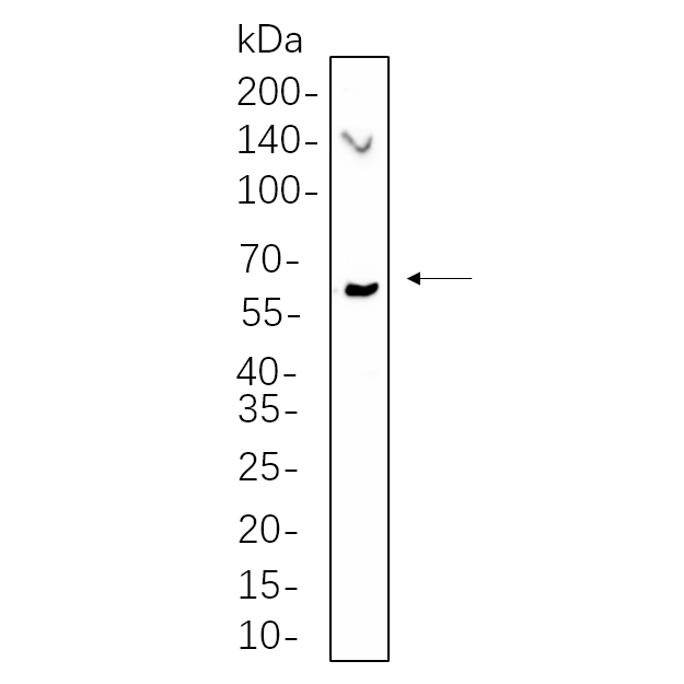 WR4507 NIH-3T3 whole cell lysates were separated by 10% SDS-PAGE, and the membrane was blotted with primary antibody(1:1000). The HRP-conjugated Goat anti-Rabbit IgG(H + L) antibody was used to detect the antibody. NIH-3T3 whole cell lysates were separated by 10% SDS-PAGE, and the membrane was blotted with primary antibody(1:1000). The HRP-conjugated Goat anti-Rabbit IgG(H + L) antibody was used to detect the antibody.