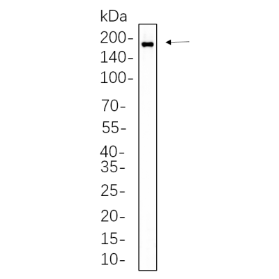 SK-BR-3 whole cell lysates were separated by 10% SDS-PAGE, and the membrane was blotted with primary antibody(1:1000). The HRP-conjugated Goat anti-Rabbit IgG(H + L) antibody was used to detect the antibody.