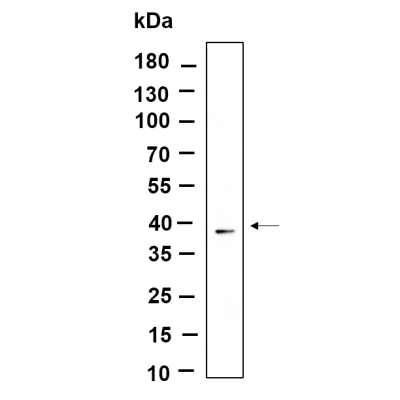 Western Blot analysis using T47D lysates,primary antibody was diluted at 1:1000, 4°over night, Dylight 800 secondary antibody(WS0446)was diluted at 1:10000, 37° 1hour.
