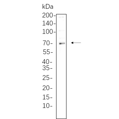 Ramos cell lysates were separated by 4-20% SDS-PAGE, and the membrane was blotted with primary antibody 1:1000. The HRP-conjugated Goat anti-Rabbit IgG(H + L) antibody was used to detect the antibody.