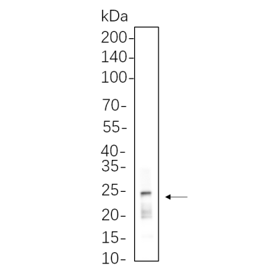 A549 cell lysates were separated by 4-20% SDS-PAGE, and the membrane was blotted with primary antibody 1:1000. The HRP-conjugated Goat anti-Rabbit IgG(H + L) antibody was used to detect the antibody.