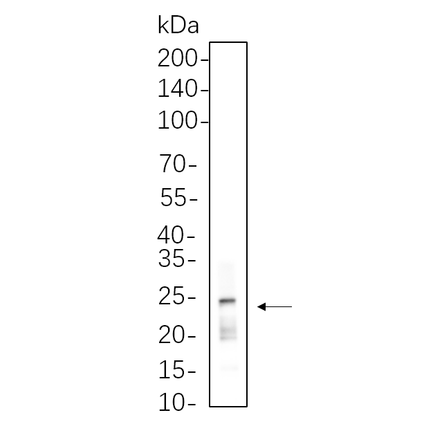 WR4546 A549 cell lysates were separated by 4-20% SDS-PAGE, and the membrane was blotted with primary antibody 1:1000. The HRP-conjugated Goat anti-Rabbit IgG(H + L) antibody was used to detect the antibody. A549 cell lysates were separated by 4-20% SDS-PAGE, and the membrane was blotted with primary antibody 1:1000. The HRP-conjugated Goat anti-Rabbit IgG(H + L) antibody was used to detect the antibody.