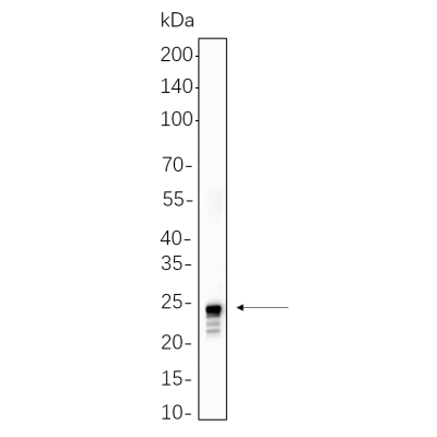 NCCIT cell lysates were separated by 4-20% SDS-PAGE, and the membrane was blotted with primary antibody 1:1000. The HRP-conjugated Goat anti-Rabbit IgG(H + L) antibody was used to detect the antibody.