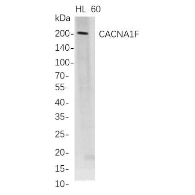 Western Blot analysis of HL-60 whole cell lysates were separated by 4-20% SDS-PAGE, and the membrane was blotted with anti-CACNA1F rabbit mAb. The HRP-conjugated Goat anti-Rabbit IgG(H + L) antibody was used to detect the antibody.