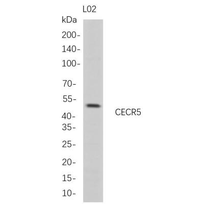 Western Blot analysis of L02 whole cell lysates were separated by 4-20% SDS-PAGE, and the membrane was blotted with anti-CECR5 rabbit mAb. The HRP-conjugated Goat anti-Rabbit IgG(H + L) antibody was used to detect the antibody.