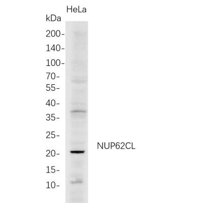 Western Blot analysis of HeLa whole cell lysates were separated by 4-20% SDS-PAGE, and the membrane was blotted with anti-NUP62CL rabbit mAb. The HRP-conjugated Goat anti-Rabbit IgG(H + L) antibody was used to detect the antibody.