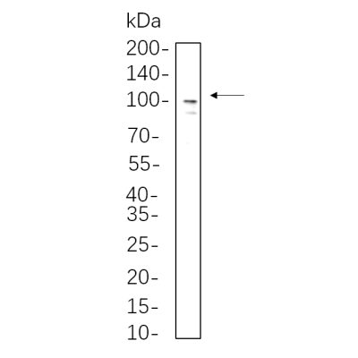 A549 whole cell lysates were separated by 10% SDS-PAGE, and the membrane was blotted with primary antibody(1:1000). The HRP-conjugated Goat anti-Rabbit IgG(H + L) antibody was used to detect the antibody.