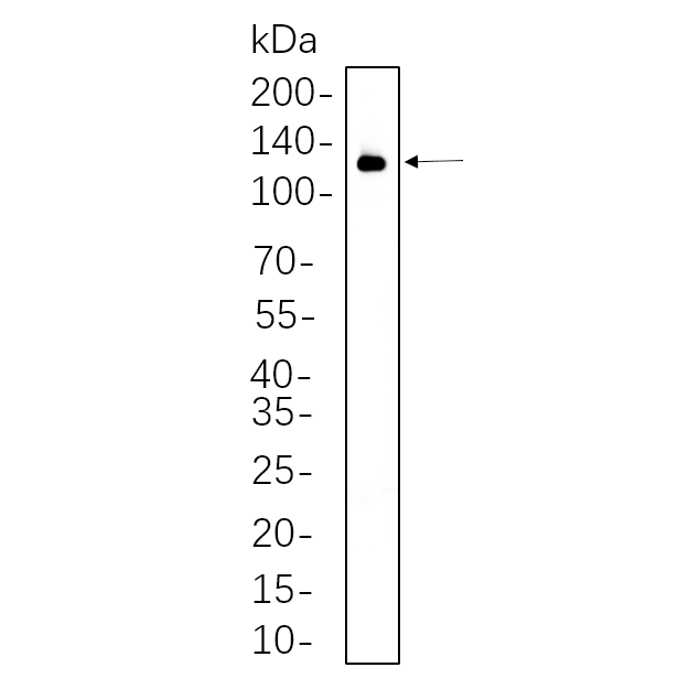 WR4568 NIH-3T3 whole cell lysates were separated by 10% SDS-PAGE, and the membrane was blotted with primary antibody(1:1000). The HRP-conjugated Goat anti-Rabbit IgG(H + L) antibody was used to detect the antibody. NIH-3T3 whole cell lysates were separated by 10% SDS-PAGE, and the membrane was blotted with primary antibody(1:1000). The HRP-conjugated Goat anti-Rabbit IgG(H + L) antibody was used to detect the antibody.