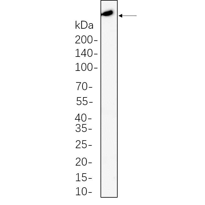 WR4569 A549 whole cell lysates were separated by 10% SDS-PAGE, and the membrane was blotted with primary antibody(1:1000). The HRP-conjugated Goat anti-Rabbit IgG(H + L) antibody was used to detect the antibody. A549 whole cell lysates were separated by 10% SDS-PAGE, and the membrane was blotted with primary antibody(1:1000). The HRP-conjugated Goat anti-Rabbit IgG(H + L) antibody was used to detect the antibody.