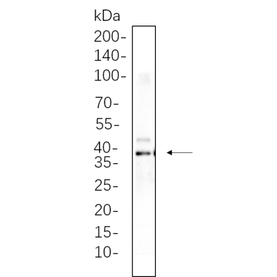 SH-SY5Y whole cell lysates were separated by 10% SDS-PAGE, and the membrane was blotted with primary antibody(1:1000). The HRP-conjugated Goat anti-Rabbit IgG(H + L) antibody was used to detect the antibody.