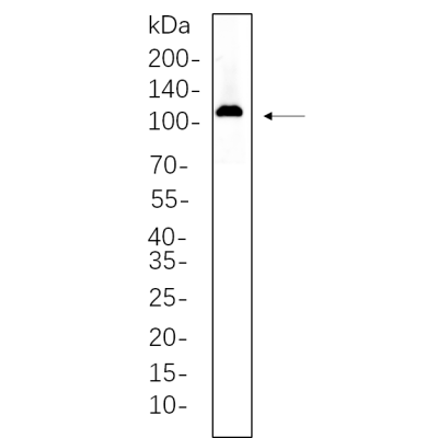 H9C2 whole cell lysates were separated by 10% SDS-PAGE, and the membrane was blotted with primary antibody(1:1000). The HRP-conjugated Goat anti-Rabbit IgG(H + L) antibody was used to detect the antibody.
