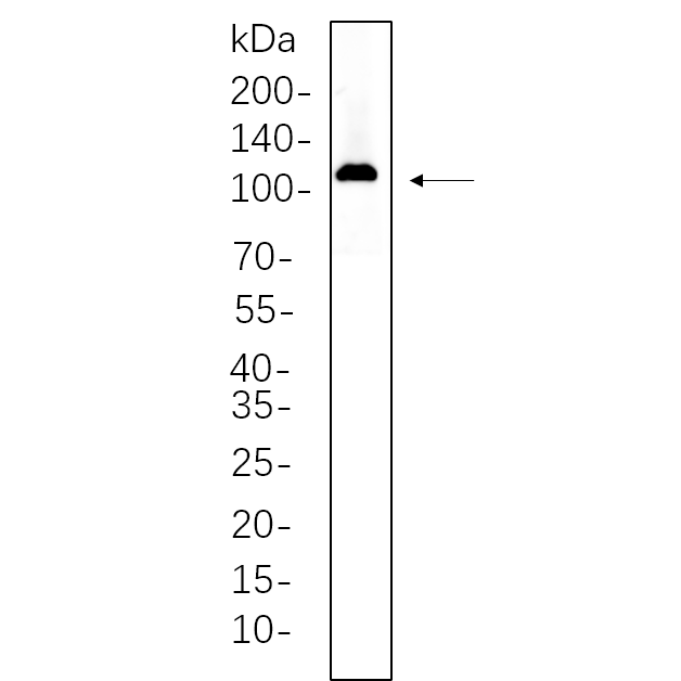 WR4574 H9C2 whole cell lysates were separated by 10% SDS-PAGE, and the membrane was blotted with primary antibody(1:1000). The HRP-conjugated Goat anti-Rabbit IgG(H + L) antibody was used to detect the antibody. H9C2 whole cell lysates were separated by 10% SDS-PAGE, and the membrane was blotted with primary antibody(1:1000). The HRP-conjugated Goat anti-Rabbit IgG(H + L) antibody was used to detect the antibody.