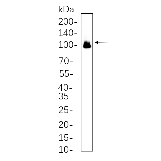 WR4579 Mouse brain whole cell lysates were separated by 10% SDS-PAGE, and the membrane was blotted with primary antibody(1:1000). The HRP-conjugated Goat anti-Rabbit IgG(H + L) antibody was used to detect the antibody. Mouse brain whole cell lysates were separated by 10% SDS-PAGE, and the membrane was blotted with primary antibody(1:1000). The HRP-conjugated Goat anti-Rabbit IgG(H + L) antibody was used to detect the antibody.
