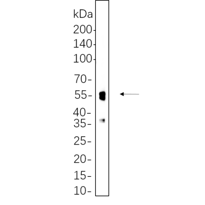 Mouse brain cell lysates were separated by 4-20% SDS-PAGE, and the membrane was blotted with primary antibody 1:1000. The HRP-conjugated Goat anti-Rabbit IgG(H + L) antibody was used to detect the antibody.