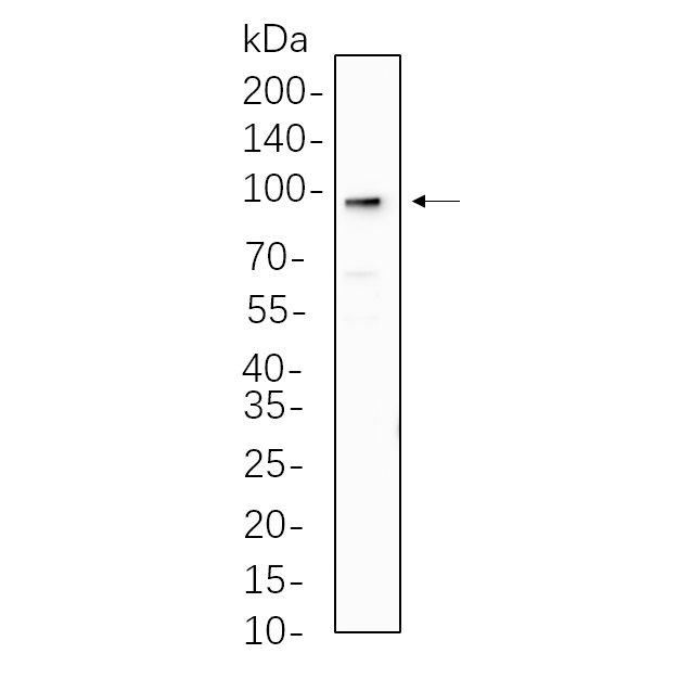 WR4581 A431 cell lysates were separated by 4-20% SDS-PAGE, and the membrane was blotted with primary antibody 1:1000. The HRP-conjugated Goat anti-Rabbit IgG(H + L) antibody was used to detect the antibody. A431 cell lysates were separated by 4-20% SDS-PAGE, and the membrane was blotted with primary antibody 1:1000. The HRP-conjugated Goat anti-Rabbit IgG(H + L) antibody was used to detect the antibody.