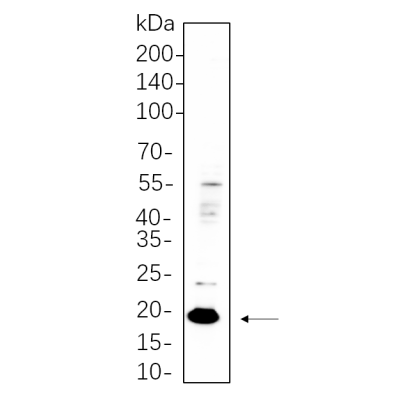 HT-29 whole cell lysates were separated by 10% SDS-PAGE, and the membrane was blotted with primary antibody(1:1000). The HRP-conjugated Goat anti-Rabbit IgG(H + L) antibody was used to detect the antibody.
