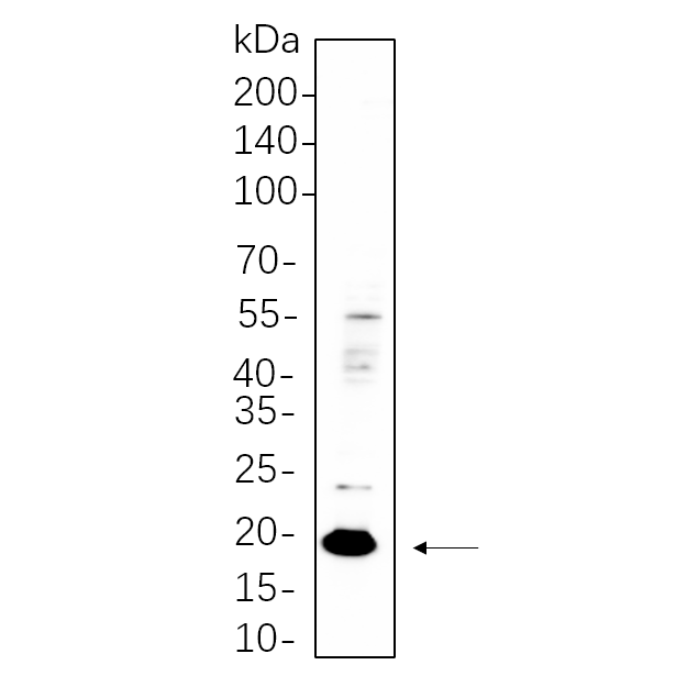 WR4583 HT-29 whole cell lysates were separated by 10% SDS-PAGE, and the membrane was blotted with primary antibody(1:1000). The HRP-conjugated Goat anti-Rabbit IgG(H + L) antibody was used to detect the antibody. HT-29 whole cell lysates were separated by 10% SDS-PAGE, and the membrane was blotted with primary antibody(1:1000). The HRP-conjugated Goat anti-Rabbit IgG(H + L) antibody was used to detect the antibody.