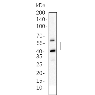C6 whole cell lysates were separated by 10% SDS-PAGE, and the membrane was blotted with primary antibody(1:1000). The HRP-conjugated Goat anti-Rabbit IgG(H + L) antibody was used to detect the antibody.