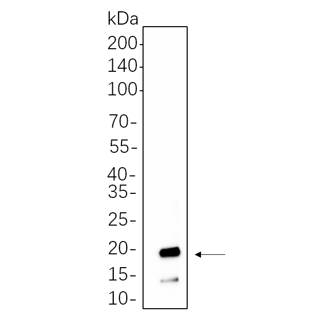 WR4587 Hela cell lysates were separated by 4-20% SDS-PAGE, and the membrane was blotted with primary antibody 1:1000. The HRP-conjugated Goat anti-Rabbit IgG(H + L) antibody was used to detect the antibody. Hela cell lysates were separated by 4-20% SDS-PAGE, and the membrane was blotted with primary antibody 1:1000. The HRP-conjugated Goat anti-Rabbit IgG(H + L) antibody was used to detect the antibody.