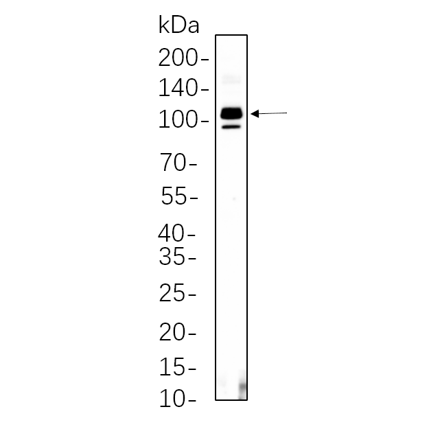WR4593 THP-1 whole cell lysates were separated by 10% SDS-PAGE, and the membrane was blotted with primary antibody(1:1000). The HRP-conjugated Goat anti-Rabbit IgG(H + L) antibody was used to detect the antibody. THP-1 whole cell lysates were separated by 10% SDS-PAGE, and the membrane was blotted with primary antibody(1:1000). The HRP-conjugated Goat anti-Rabbit IgG(H + L) antibody was used to detect the antibody.