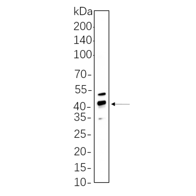 Hela cell lysates were separated by 4-20% SDS-PAGE, and the membrane was blotted with primary antibody 1:1000. The HRP-conjugated Goat anti-Rabbit IgG(H + L) antibody was used to detect the antibody.