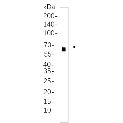 HEK293 whole cell lysates were separated by 10% SDS-PAGE, and the membrane was blotted with primary antibody(1:1000). The HRP-conjugated Goat anti-Rabbit IgG(H + L) antibody was used to detect the antibody.