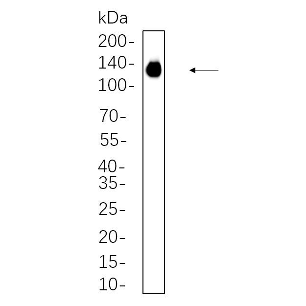 WR4602 RAW264.7 whole cell lysates were separated by 10% SDS-PAGE, and the membrane was blotted with primary antibody(1:1000). The HRP-conjugated Goat anti-Rabbit IgG(H + L) antibody was used to detect the antibody. RAW264.7 whole cell lysates were separated by 10% SDS-PAGE, and the membrane was blotted with primary antibody(1:1000). The HRP-conjugated Goat anti-Rabbit IgG(H + L) antibody was used to detect the antibody.