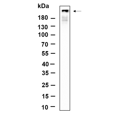 Western Blot analysis using Hela lysates,primary antibody was diluted at 1:1000, 4°over night, Dylight 800 secondary antibody(WS0446)was diluted at 1:10000, 37° 1hour.